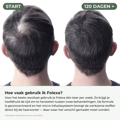 Voor en na 120 dagen, met uitleg hoe vaak je Folexa gebruikt